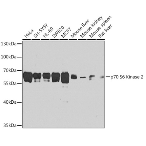 p70 S6 Kinase 2 Rabbit pAb