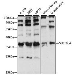 SULT1C4 Rabbit pAb