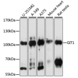 [KO Validated] GIT1 Rabbit pAb