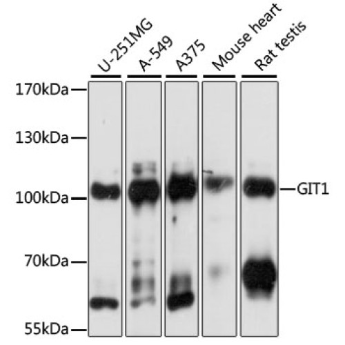 [KO Validated] GIT1 Rabbit pAb