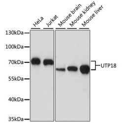 UTP18 Rabbit pAb