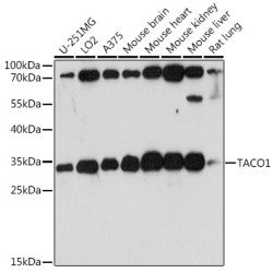 TACO1 Rabbit pAb