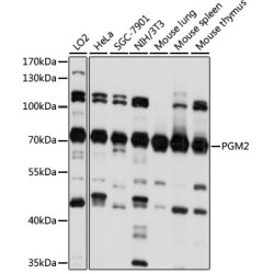 PGM2 Rabbit pAb