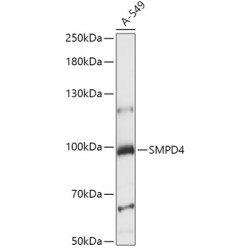 SMPD4 Rabbit pAb