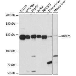 RBM25 Rabbit pAb