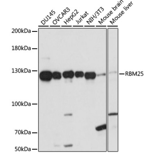 RBM25 Rabbit pAb