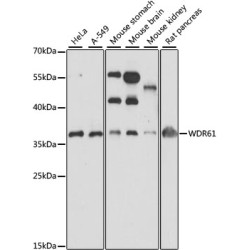 WDR61 Rabbit pAb