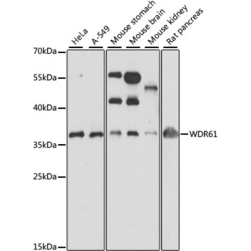 WDR61 Rabbit pAb