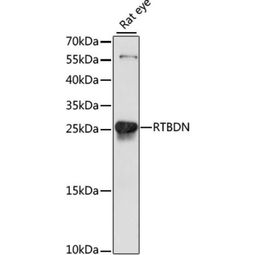 RTBDN Rabbit pAb