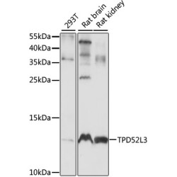 TPD52L3 Rabbit pAb
