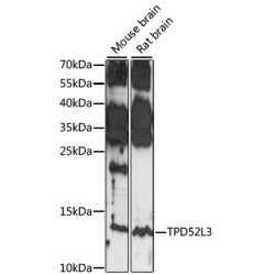 TPD52L3 Rabbit pAb