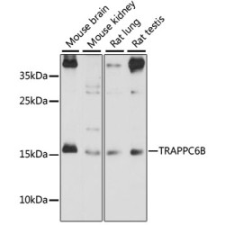 TRAPPC6B Rabbit pAb