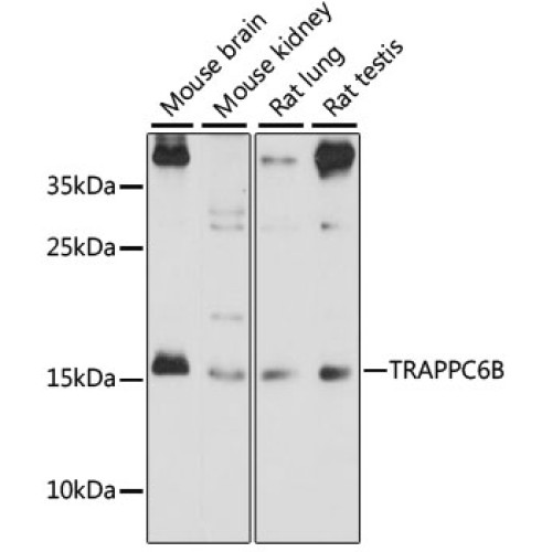 TRAPPC6B Rabbit pAb