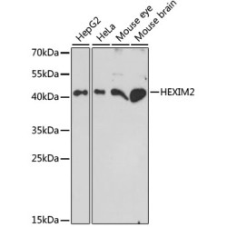 HEXIM2 Rabbit pAb