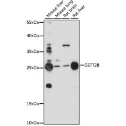GSTT2B Rabbit pAb