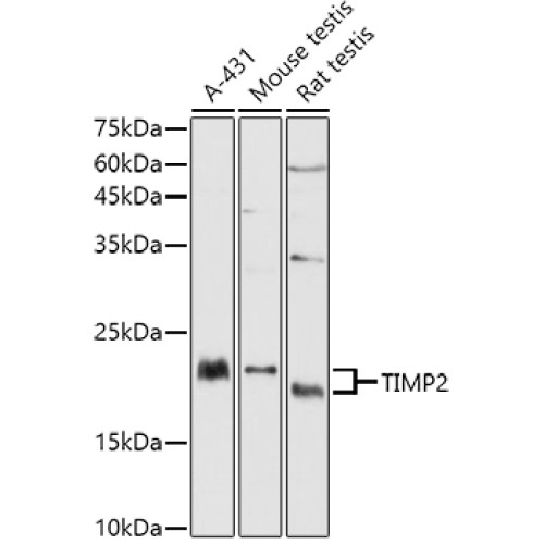 TIMP2 Rabbit pAb