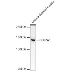 COL2A1 Rabbit pAb