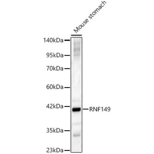 RNF149 Rabbit pAb
