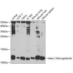 beta 2 Microglobulin Rabbit pAb