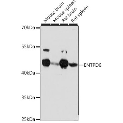 ENTPD6 Rabbit pAb