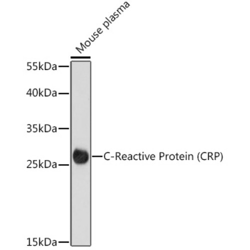 C-Reactive Protein (CRP) Rabbit pAb