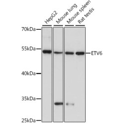ETV6 Rabbit pAb