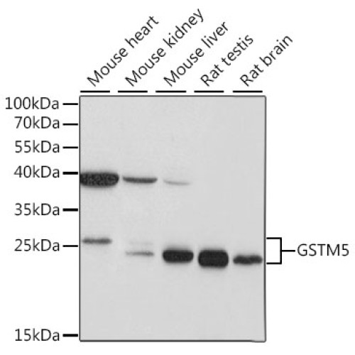 GSTM5 Rabbit pAb