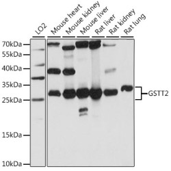 GSTT2 Rabbit pAb