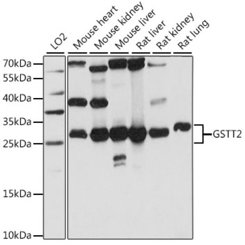 GSTT2 Rabbit pAb