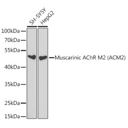 Muscarinic AChR M2 (ACM2) Rabbit pAb
