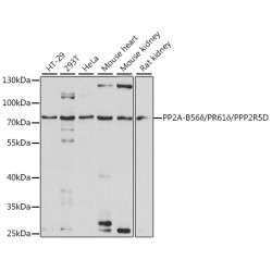 PP2A-B56δ/PR61δ/PPP2R5D Rabbit pAb