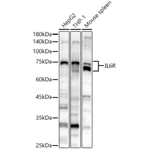 IL6R Rabbit pAb