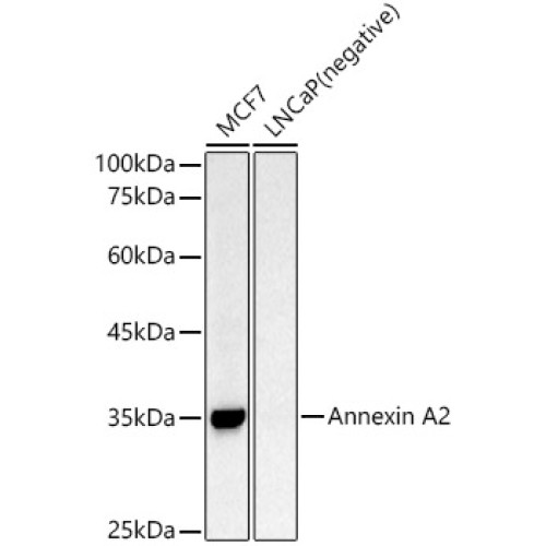 Annexin A2 Rabbit pAb