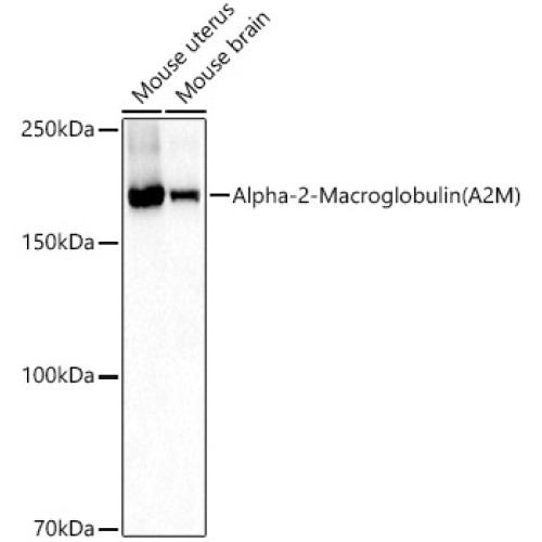 Alpha-2-Macroglobulin (A2M) Rabbit pAb