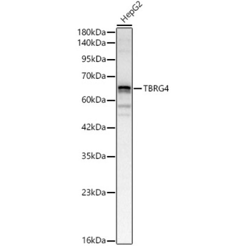 TBRG4 Rabbit pAb