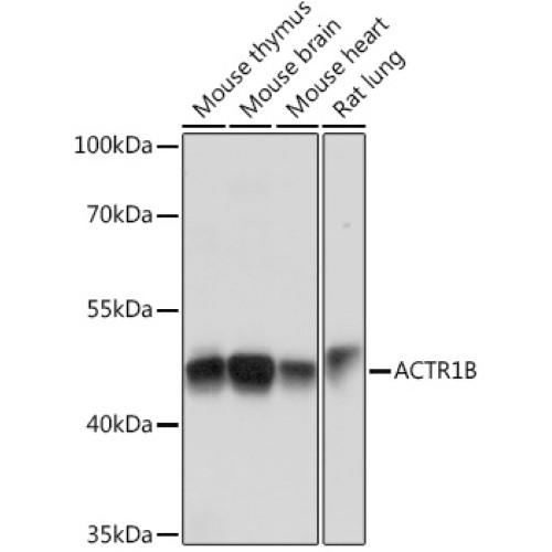 ACTR1B Rabbit pAb