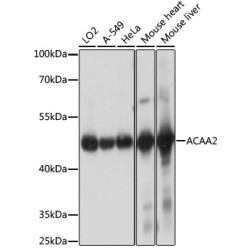 ACAA2 Rabbit pAb