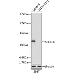[KO Validated] SEC61B Rabbit pAb