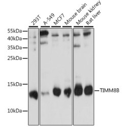 TIMM8B Rabbit pAb
