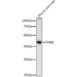 TRβ1/THRB Rabbit pAb