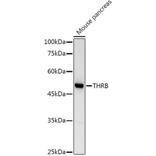 TRβ1/THRB Rabbit pAb