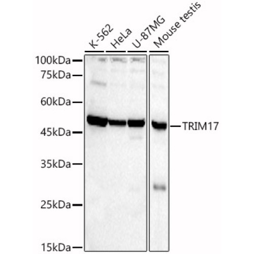TRIM17 Rabbit pAb
