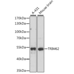 TRIM62 Rabbit pAb