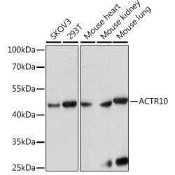 ACTR10 Rabbit pAb