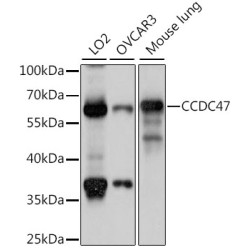 CCDC47 Rabbit pAb