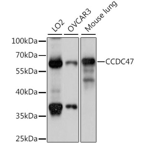 CCDC47 Rabbit pAb