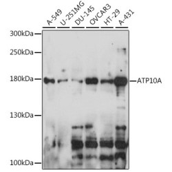 ATP10A Rabbit pAb