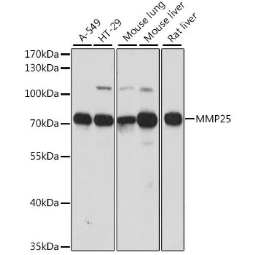 MMP25 Rabbit pAb