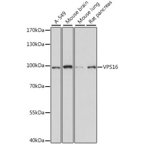 VPS16 Rabbit pAb