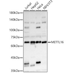 METTL16 Rabbit pAb